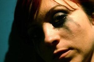 Kendine Zarar Verme İsteği