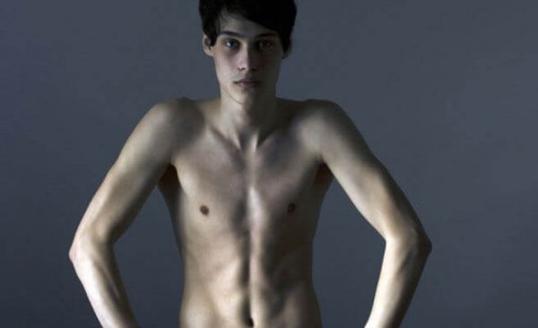 anoreksi sıkıntılı genç