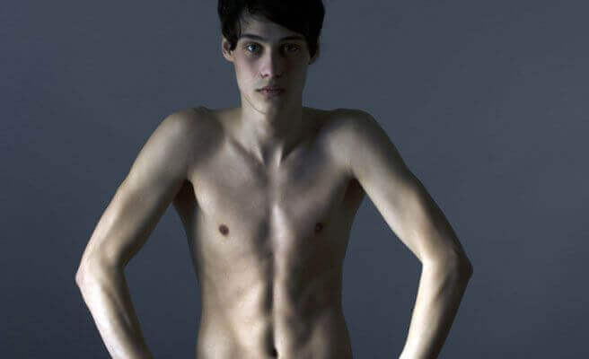 yemek yemeyerek kendine zarar veren insanlar