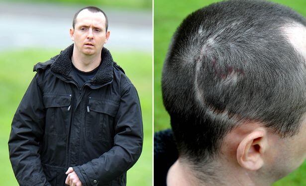 paul pugh ve patolojik kahkaha vakası