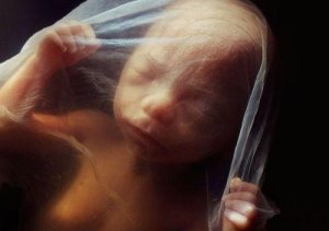 Otto Rank ve Doğum Travması