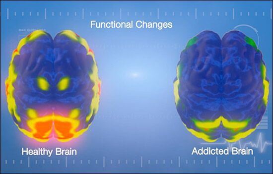 sağlıklı beyin ve bağımlı beyin karşılaştırması
