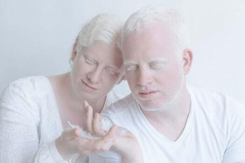 albino bir çift