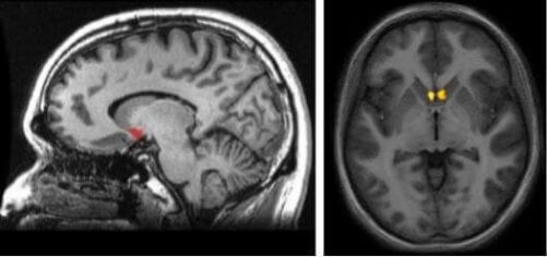 beyin röntgeni