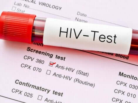 HIV testi
