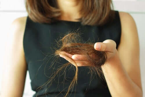 saç dökülmesi yaşayan kadın