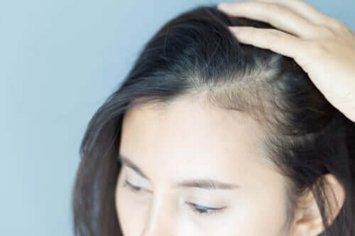 Kadınlarda Saç Dökülmesi ve Psikolojik Etkileri
