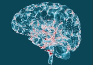 Huntington Hastalığı: Özellikleri ve İşaretleri