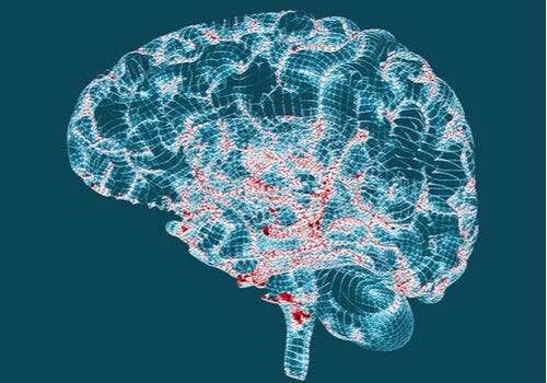 Huntington Hastalığı: Özellikleri ve İşaretleri