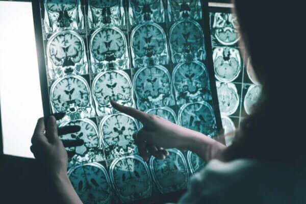 Alzheimer Tedavisi İçin Beyin Dalgalarının Uyarılması