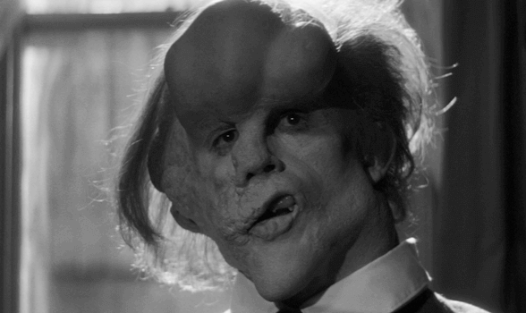 Fil Adam, İnsan Onurunun Bir Yansıması