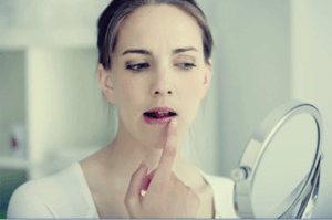 Uçuklar ve Stres Arasındaki İlginç İlişki