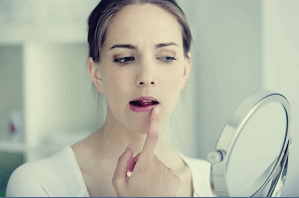 Uçuklar ve Stres Arasındaki İlginç İlişki